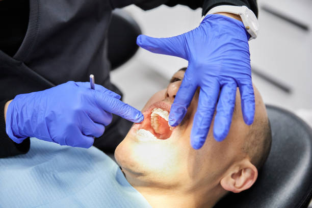 Best Emergency Root Canal Treatment in Gluckstadt, MS